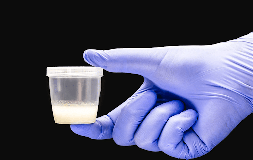 Sperm Donation: Modern World – Modern Pregnancy Opportunities