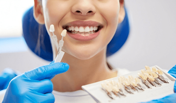 Worried Your Veneers Won’t Look Natural?